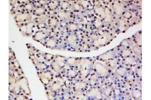 Paraformaldehyde-fixed, paraffin embedded rat pancreas, Antigen retrieval by boiling in sodium citrate buffer (pH6) for 15min, Block endogenous peroxidase by 3% hydrogen peroxide for 30 minutes, Blocking buffer (normal goat serum) at 37°C for 20min, Antibody incubation with Rabbit Anti-TNFAIP1 Polyclonal Antibody, Unconjugated  at 1:200 overnight at 4°C, followed by a conjugated secondary and DAB staining. (TNFAIP1 antibody  (AA 231-316))