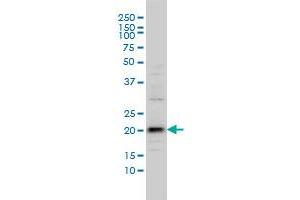 C20orf102 monoclonal antibody (M01), clone 3B9 Western Blot analysis of C20orf102 expression in IMR-32 . (VSTM2L antibody  (AA 25-204))