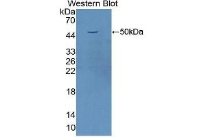 Detection of Recombinant FASL, Human using Polyclonal Antibody to Factor Related Apoptosis Ligand (FASL) (FASL antibody  (AA 103-281))