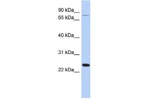 RPS7 antibody used at 1 ug/ml to detect target protein.