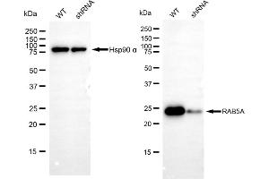 Western blotting analysis using RAB5A antibody (ABIN7800098). (Recombinant RAB5 antibody)
