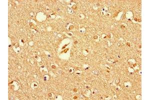 Immunohistochemistry of paraffin-embedded human brain tissue using ABIN7166261 at dilution of 1:100 (Unc-79 Homolog (C. Elegans) (UNC79) (AA 1562-1678) antibody)