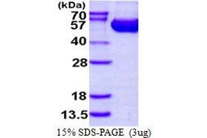 SDS-PAGE (SDS) image for Argininosuccinate Lyase (ASL) (AA 1-464) protein (His tag) (ABIN667597) (ASL Protein (AA 1-464) (His tag))