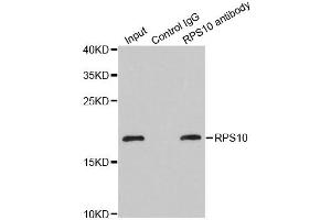 Immunoprecipitation analysis of 200 μg extracts of MCF-7 cells using 1 μg RPS10 antibody (ABIN5973486).