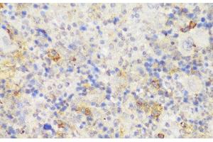 Immunohistochemistry of paraffin-embedded Mouse spleen using GCC2 Polyclonal Antibody at dilution of 1:150 (40x lens).
