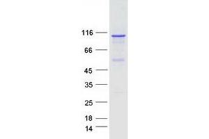 Dual serine/threonine and tyrosine Protein Kinase (DSTYK) (Transcript Variant 1) protein (Myc-DYKDDDDK Tag)