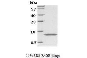 Figure annotation denotes ug of protein loaded and % gel used. (GM-CSF Protein)
