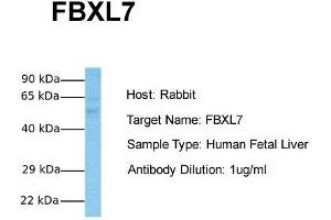 Host:  Rabbit  Target Name:  FBXL7  Sample Tissue:  Human Fetal Liver  Antibody Dilution:  1. (FBXL7 antibody  (N-Term))