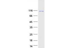 KIF11 Protein (Myc-DYKDDDDK Tag)