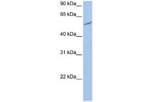 WB Suggested Anti-RIOK3  Antibody Titration: 0. (RIOK3 antibody  (C-Term))
