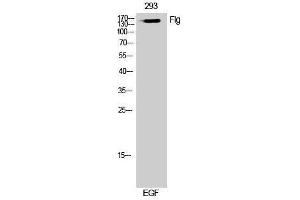 Western Blotting (WB) image for anti-Filaggrin (FLG) (Ser378) antibody (ABIN3184631) (Filaggrin antibody  (Ser378))