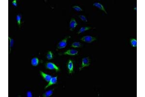 Immunofluorescent analysis of Hela cells using ABIN7158772 at dilution of 1:100 and Alexa Fluor 488-congugated AffiniPure Goat Anti-Rabbit IgG(H+L) (PQLC2 antibody  (AA 91-150))