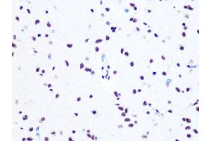 Immunohistochemistry of paraffin-embedded rat brain using L Rabbit mAb (ABIN7270266) at dilution of 1:100 (40x lens). (ASH2L antibody)