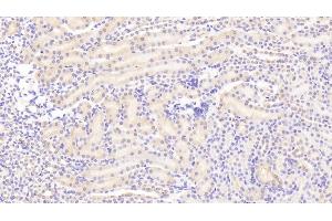 Immunohistochemistry (IHC) image for anti-Transferrin Receptor (p90, CD71) (TFRC) (AA 572-757) antibody (ABIN7437035)