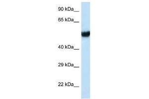 Western Blot showing IFT74 antibody used at a concentration of 1 ug/ml against MCF7 Cell Lysate (IFT74 antibody  (C-Term))