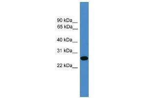 TIMP2 antibody used at 0. (TIMP2 antibody  (N-Term))