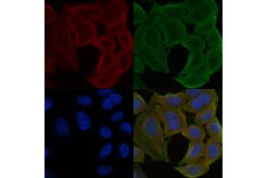 ABIN6257876 and ABIN6275617 staining Hela cells(30 min of UV treatment) by IF/ICC. (SYT13 antibody  (Internal Region))