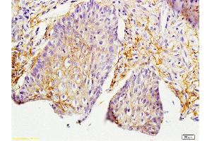 Formalin-fixed and paraffin embedded rat skin labeled with Anti-MIF Polyclonal Antibody, Unconjugated  at 1:200 followed by conjugation to the secondary antibody and DAB staining. (MIF antibody  (AA 51-115))