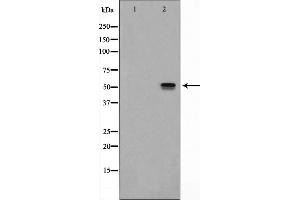 Western blot analysis on HeLa cell lysate using ITPK1 Antibody,The lane on the left is treated with the antigen-specific peptide. (ITPK1 antibody  (Internal Region))