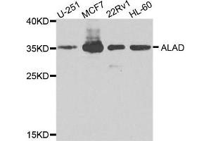 Western blot analysis of extracts of various cells, using ALAD antibody. (ALAD antibody)