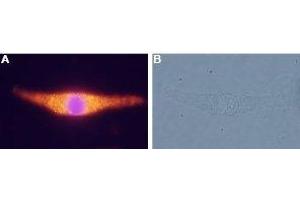Expression of NTR2 in rat C6 glioma cells - Immunocytochemical staining of rat C6 glioma cells. (NTSR2 antibody  (C-Term, Intracellular))