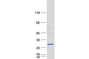 Validation with Western Blot