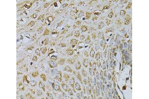Immunohistochemistry of paraffin-embedded Human esophagus using CDA Polyclonal Antibody at dilution of 1:100 (40x lens).