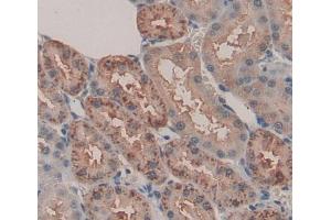 Used in DAB staining on fromalin fixed paraffin- embedded kidney tissue (ACP6 antibody  (AA 33-413))