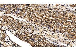 Detection of IRAK4 in Mouse Kidney Tissue using Polyclonal Antibody to Interleukin 1 Receptor Associated Kinase 4 (IRAK4) (IRAK4 antibody  (AA 189-427))