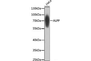 Western blot analysis of extracts of HeLa cells using ALPP Polyclonal Antibody at dilution of 1:1000. (PLAP antibody)