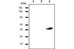 Western Blotting (WB) image for anti-Ras Association (RalGDS/AF-6) Domain Family Member 1 (RASSF1) antibody (ABIN165456)