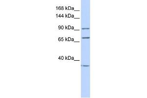 WB Suggested Anti-EEF2 Antibody Titration: 0. (EEF2 antibody  (N-Term))