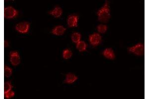 Immunofluorescence (fixed cells) (IF/ICC) image for anti-Receptor Tyrosine-Protein Kinase ErbB-3 (ERBB3) (C-Term) antibody (ABIN6261585)