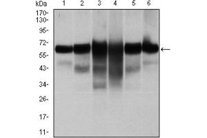 Western blot analysis using CK5 antibody against human CK5 (AA: 158-272) recombinant protein. (Cytokeratin 5 antibody)