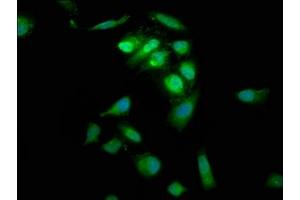Immunofluorescence staining of Hela cells with ABIN7166237 at 1:66, counter-stained with DAPI. (PTP4A2 antibody  (AA 1-164))