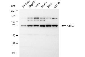 Western blotting analysis using GRK2 antibody (ABIN7797537).