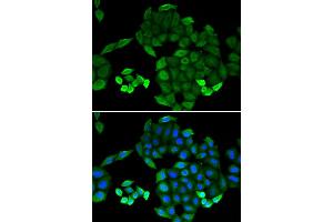 Immunofluorescence (IF) image for anti-6-Pyruvoyltetrahydropterin Synthase (PTS) antibody (ABIN1980322) (PTS antibody)