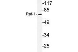 Western blot analyzes of Raf-1 antibody in extracts from RAW264. (RAF1 antibody)