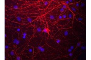 Immunostaining of cultured rat neurons and glia showing labeling of NF-M in red. (NEFM antibody  (C-Term))