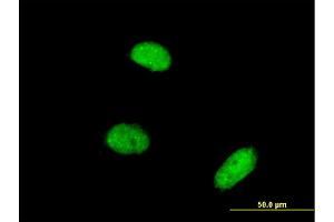 Immunofluorescence of monoclonal antibody to AKIRIN2 on HeLa cell.