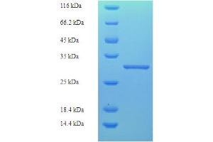 SDS-PAGE (SDS) image for Kallikrein 7 (KLK7) (AA 25-261) protein (His tag) (ABIN5709813)
