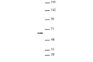 HNF4A antibody (pAb) tested by Western blot. (HNF4A antibody  (N-Term))