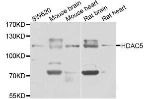 Western blot analysis of extracts of various cell lines, using HDAC5 antibody.