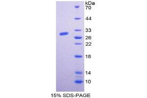 SDS-PAGE (SDS) image for Hepatoma-Derived Growth Factor (HDGF) (AA 10-240) protein (His tag) (ABIN2125186)