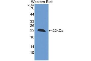 Detection of Recombinant PARK7, Rat using Monoclonal Antibody to Parkinson Disease Protein 7 (PARK7) (PARK7/DJ1 antibody  (AA 1-189))