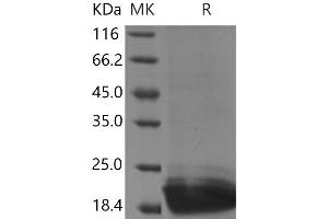 Peptidoglycan Recognition Protein 1 (PGLYRP1) protein (His tag)