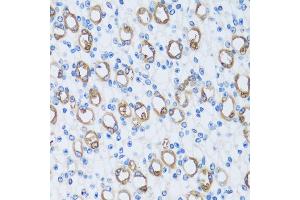 Immunohistochemistry (IHC) image for anti-Carbonic Anhydrase XIII (CA13) (AA 1-220) antibody (ABIN7266074)