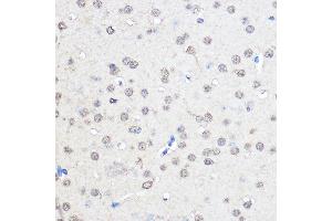 Immunohistochemistry of paraffin-embedded Mouse brain using CNOT7 Rabbit pAb (ABIN6127563, ABIN6138783, ABIN6138784 and ABIN6224834) at dilution of 1:50 (40x lens). (CNOT7 antibody  (AA 90-160))