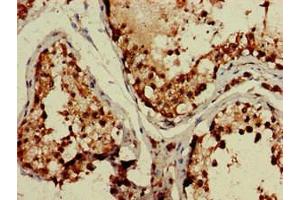 Immunohistochemistry of paraffin-embedded human testis tissue using ABIN7171602 at dilution of 1:100 (TBC1D15 antibody  (AA 283-404))