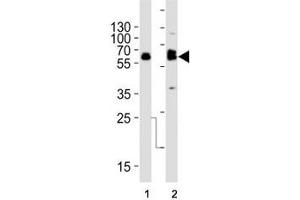Western blot analysis of lysate from (1) SW480 and (2) U-87 MG cell line using TH antibody at 1:1000.